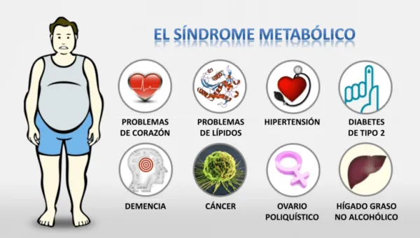 imagen que representa el síndrome metabólico